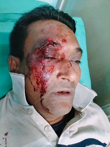 নড়িয়ায় ঈগলের মিছিলে নৌকার সমর্থকদের হামলা,