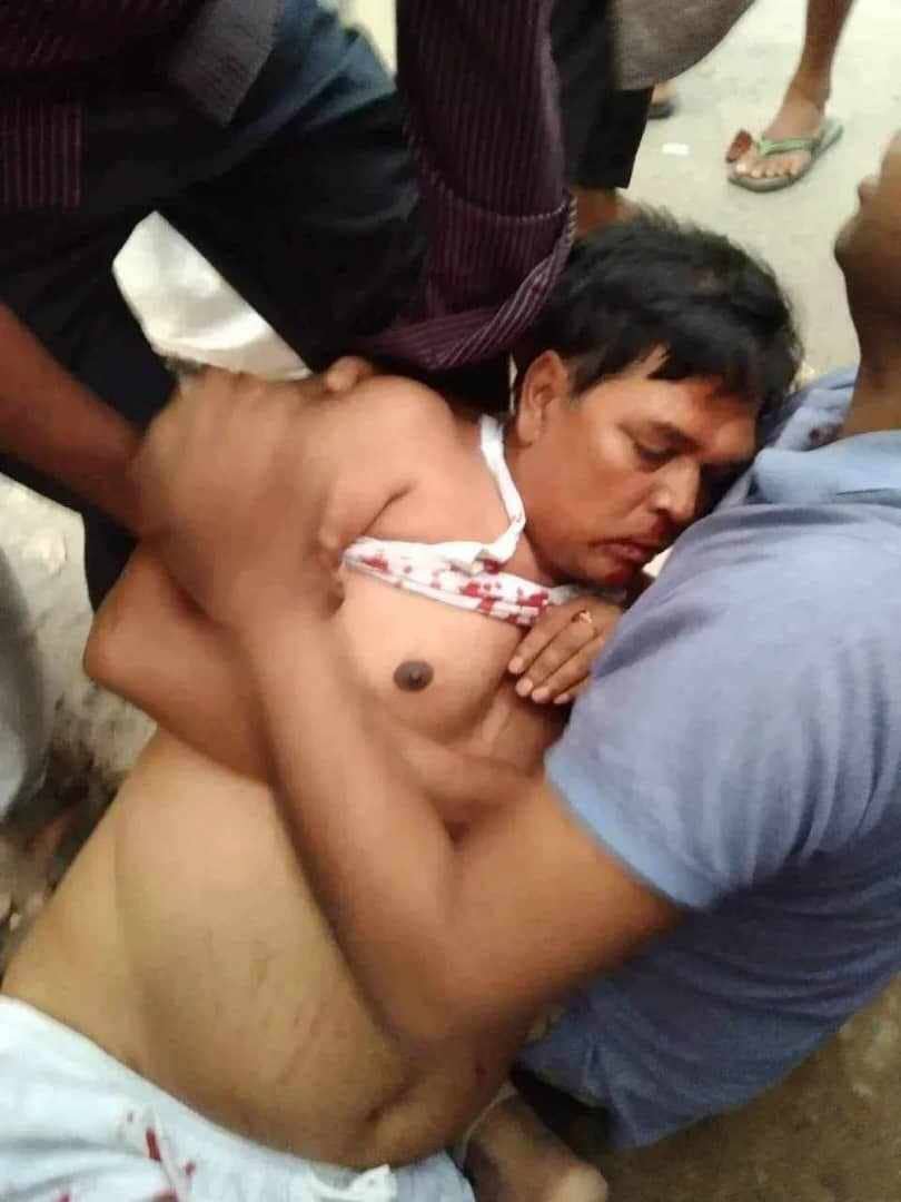 নড়িয়ায় নির্বাচনোত্তর সহিংসতা, আহত ৩